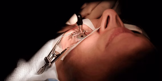 How Much Does Laser Eye Surgery Cost In Australia Today?