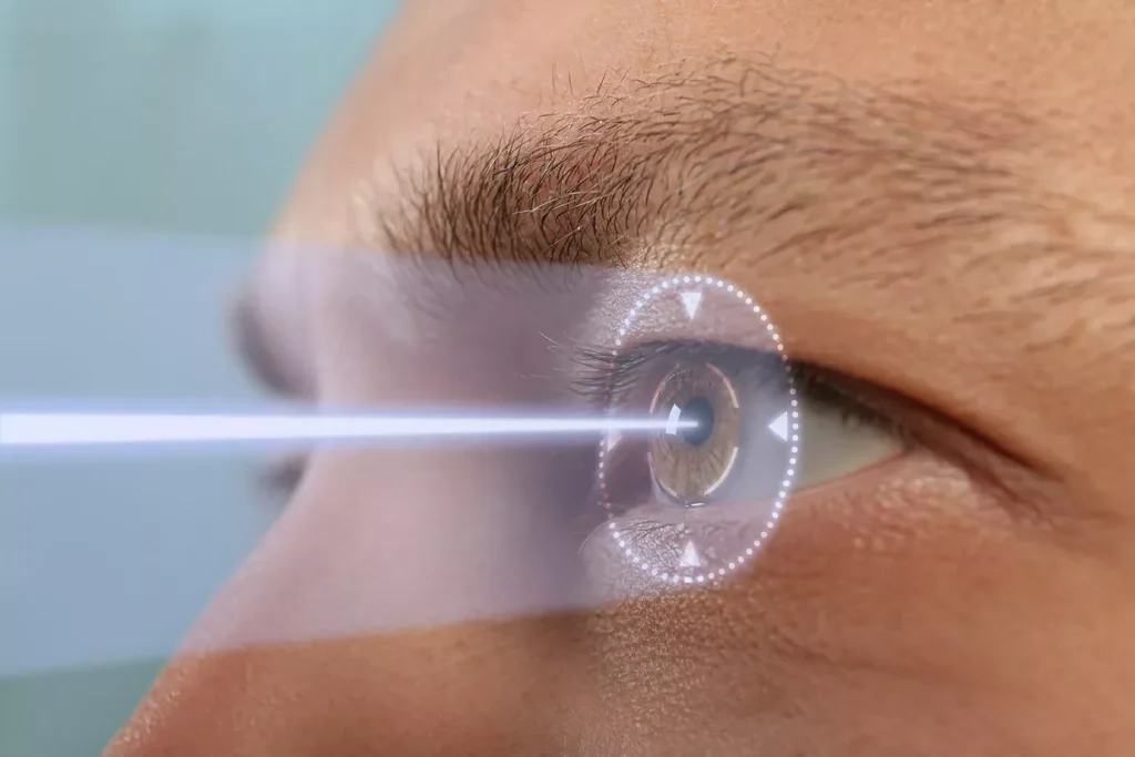 How Much Does Laser Eye Surgery Cost In Australia Today?